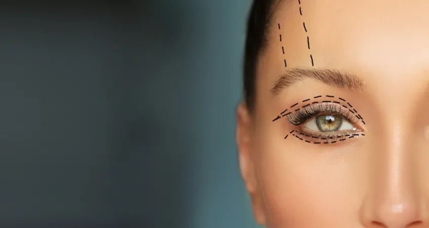 Blepharoplastyka - operacje powiek