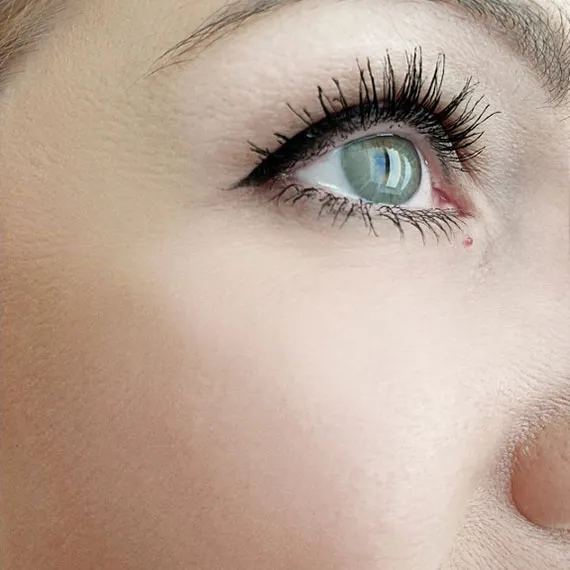 Usuwanie zmarszczek i blizn laserem CO2